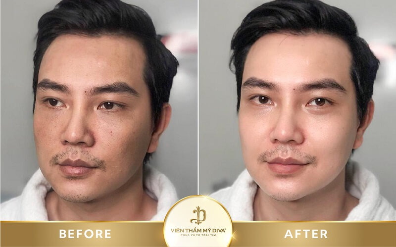 Hình ảnh trước - sau điều trị