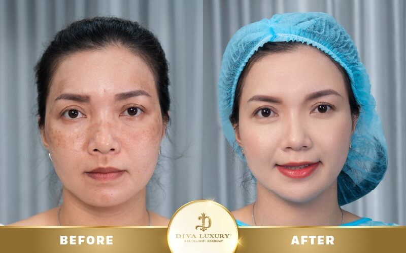 chuong-trinh-noel-vien-tham-my-diva chuong-trinh-noel-vien-tham-my-diva