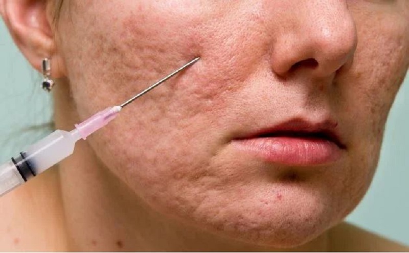 Tiêu chí lựa chọn cơ sở trị sẹo ở Châu Đốc uy tín, an toàn và uy tín nhất