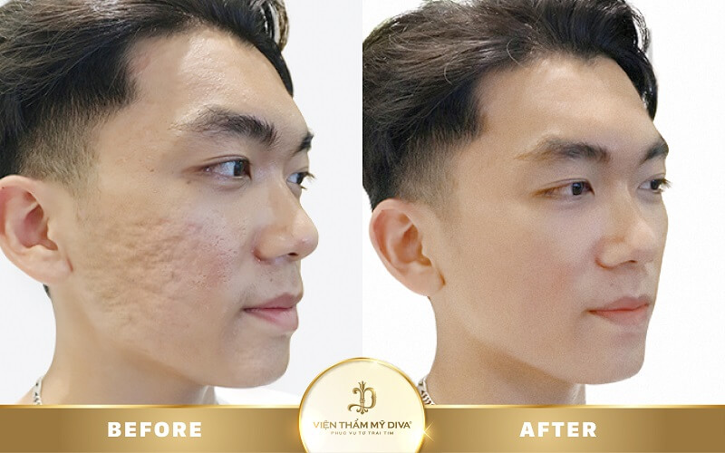 Hình ảnh trước - sau điều trị