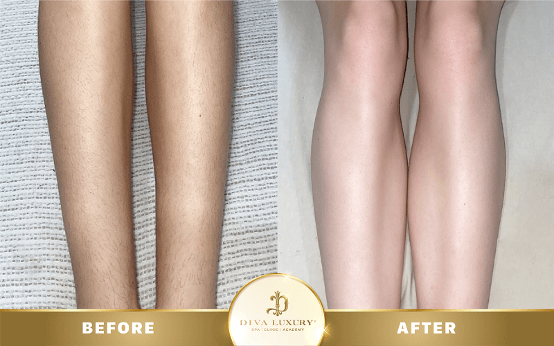 triet-long-tai-tra-vinh-8