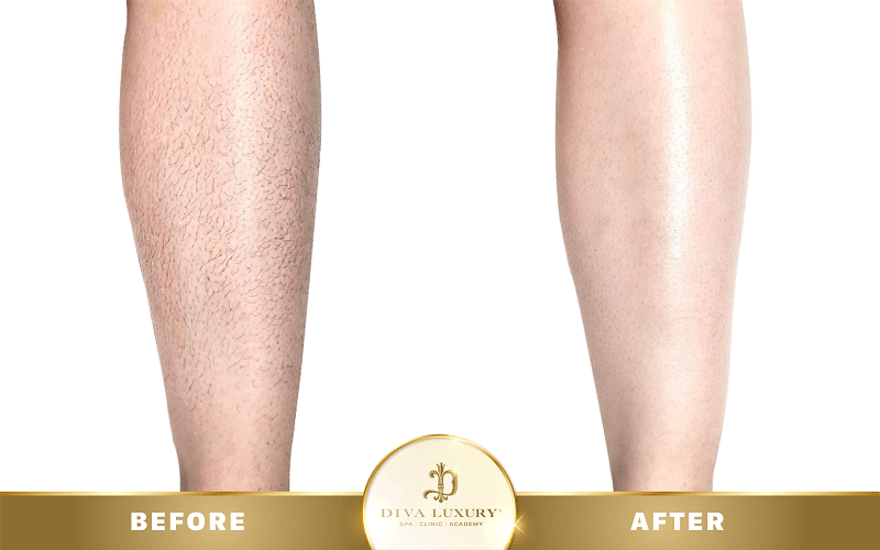 triet-long-o-tien-giang-12