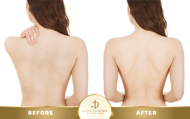 vien-tham-my-diva-quy-nhon-5