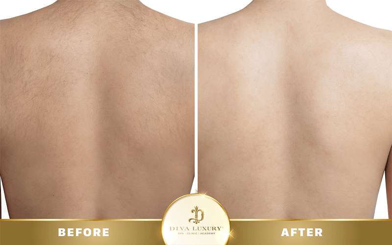 triet-long-o-tien-giang-14