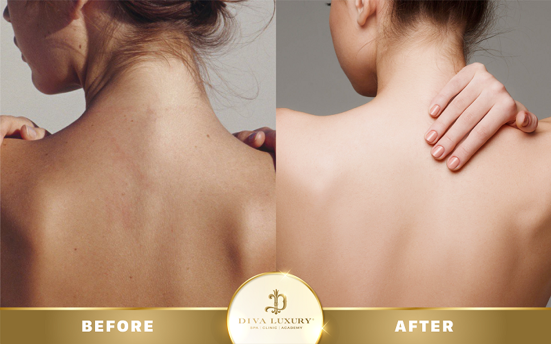 chuong-trinh-noel-vien-tham-my-diva chuong-trinh-noel-vien-tham-my-diva