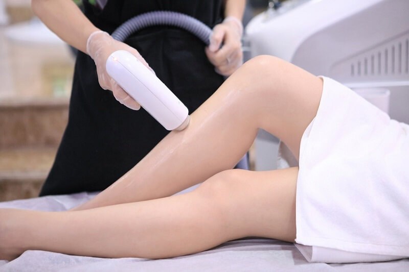 Triệt lông tại Viện thẩm mỹ DIVA
