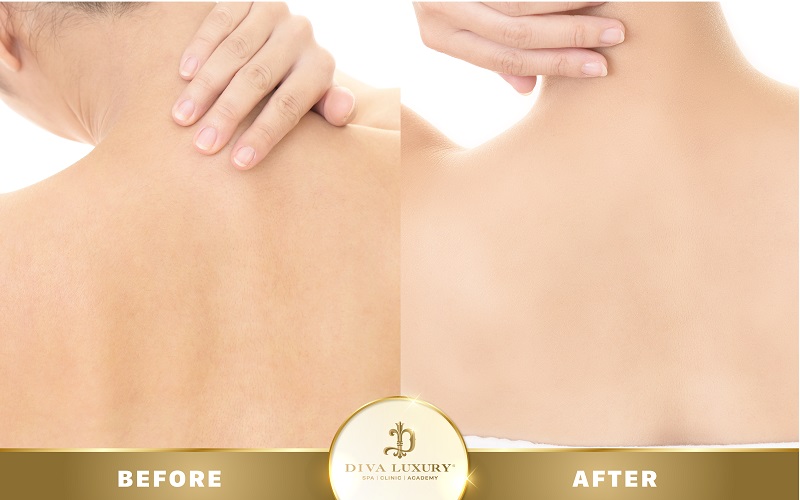 spa-quang-nam spa-quang-nam-9