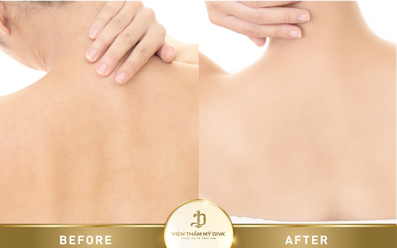 Hình ảnh trước - sau điều trị
