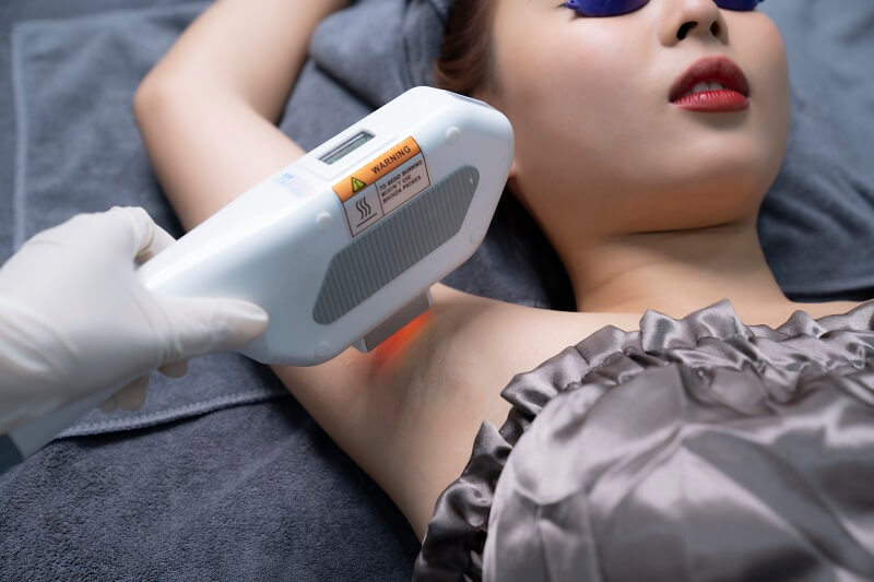 Công nghệ triệt lông tại Viện thẩm mỹ DIVA hiện đại và tân tiến nhất