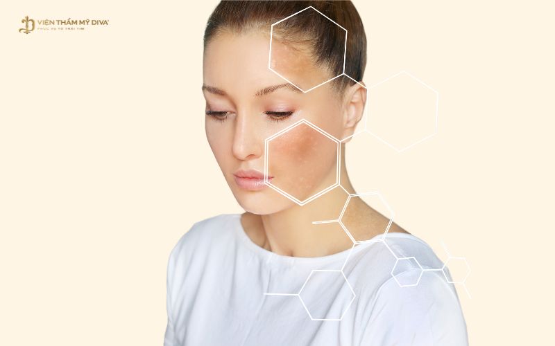 Phương pháp vi kim có thể giải quyết nhiều vấn đề da khác nhau
