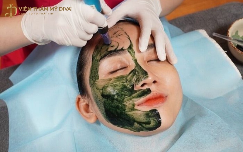 Vi kim tảo biển sử dụng đầu kim silica siêu nhỏ kích thích sản sinh collagen