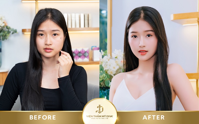 Viện thẩm mỹ DIVA triển khai đa dạng dịch vụ làm đẹp
