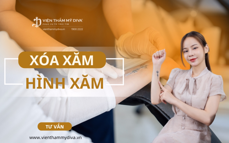 Hướng dẫn xóa hình xăm – An toàn và hiệu quả