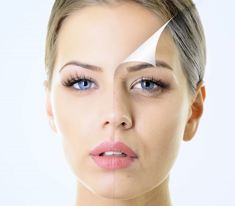 Phương pháp xóa nếp nhăn làm tăng sinh collagen, elastin giúp làn da trở nên săn chắc, đàn hồi Tìm hiểu về phương pháp xóa nếp nhăn