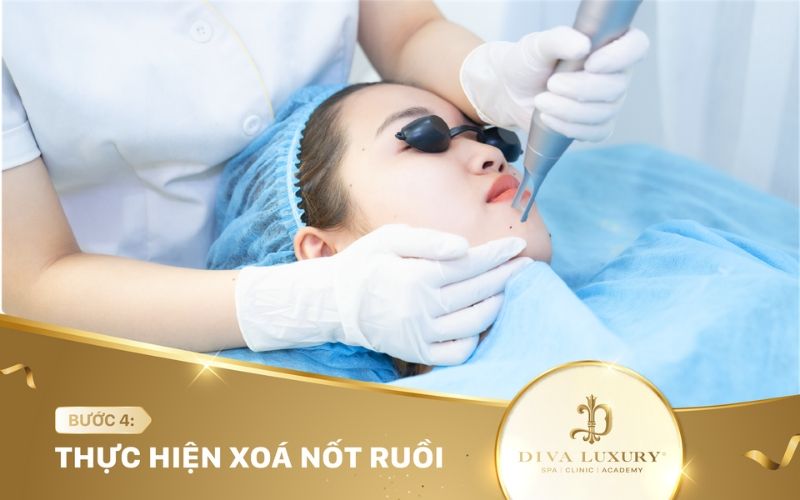 xoa-not-ruoi-o-tuy-hoa-7