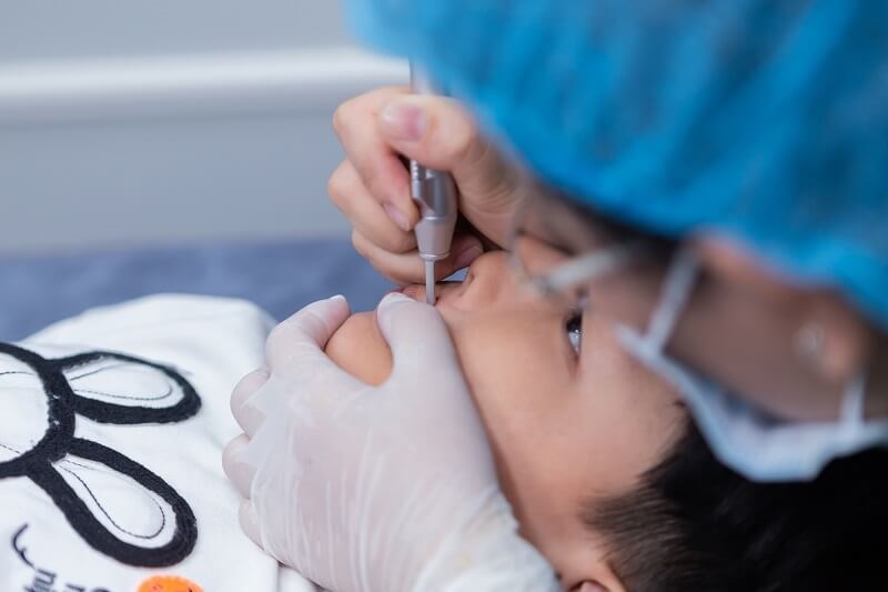 Ưu điểm xóa nốt ruồi