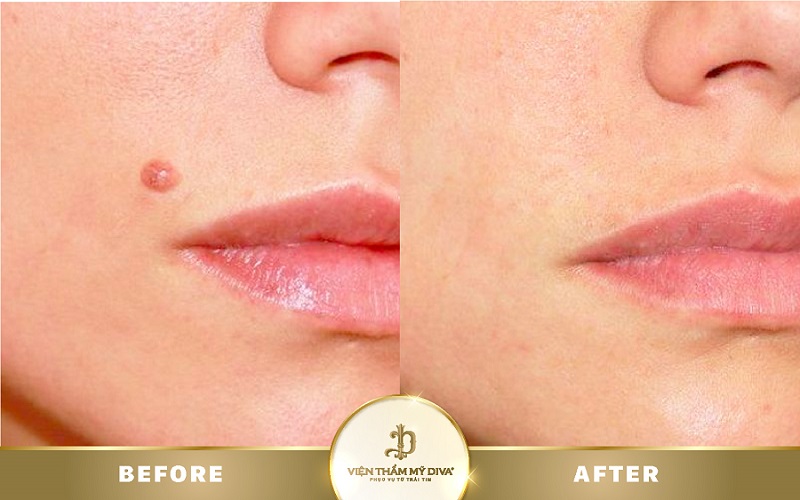 tay-not-ruoi-to-va-loi-10