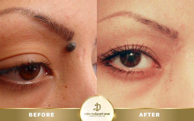 tay-not-ruoi-to-va-loi-7