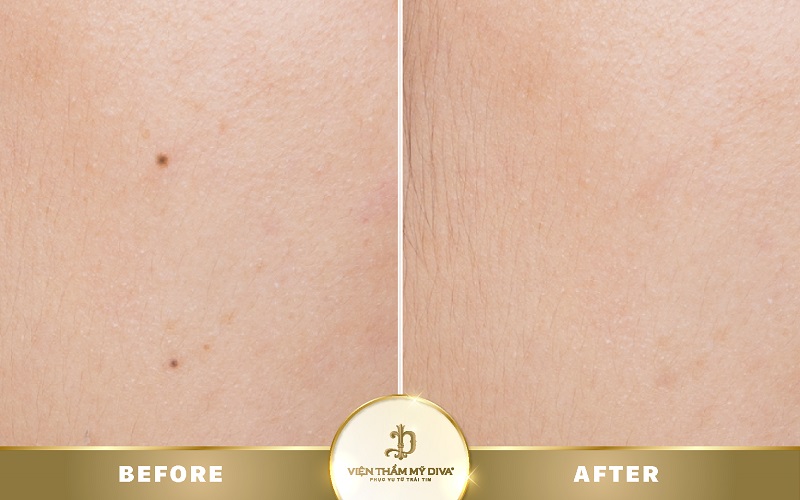 tay-not-ruoi-to-va-loi-6