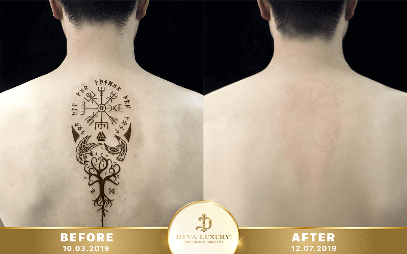 xoa-xam-da-nang xoa-xam-da-nang-10