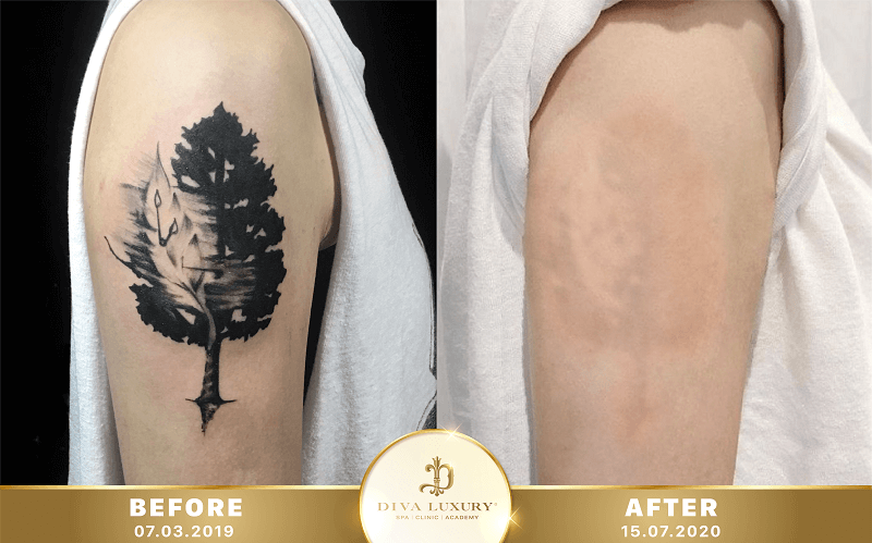 xoa-xam-da-nang xoa-xam-da-nang-8