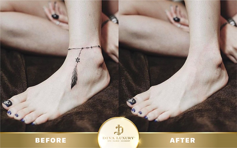 xoa-xam-da-nang xoa-xam-da-nang-6