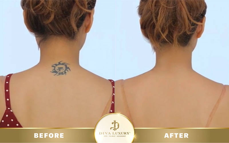 xoa-xam-da-nang xoa-xam-da-nang-5