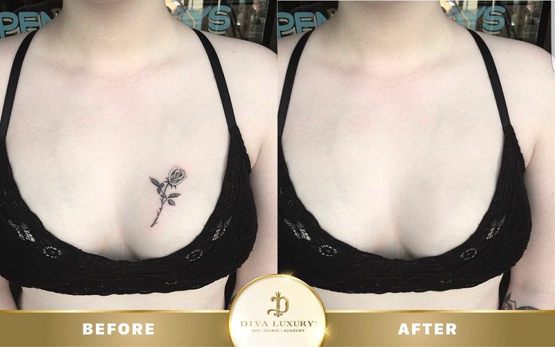 xoa-xam-da-nang xoa-xam-da-nang-4