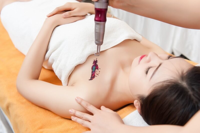 xoa-xam-tai-rach-gia xóa xăm tại rạch giá